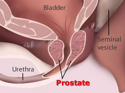 PROSTRATE-DIAGRAM