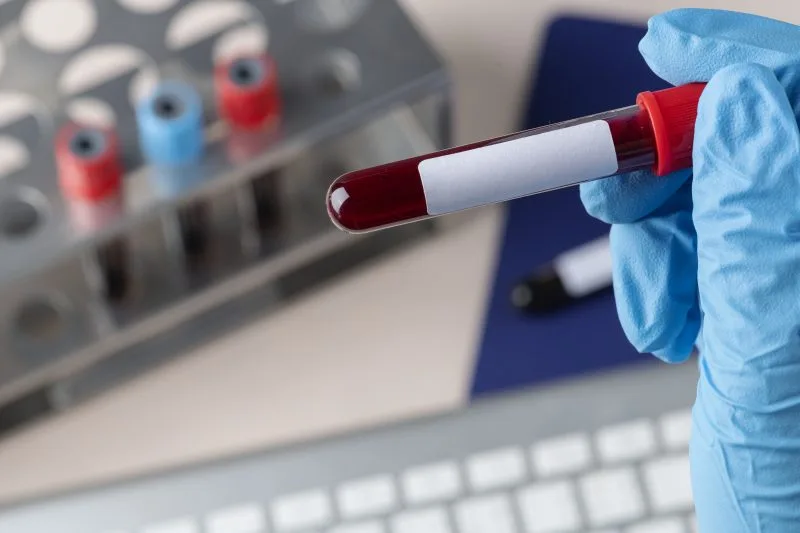 Kenya’s Blood Shortage Crisis Runs Deeper Than a Lack of Donors, Landmark Lancet Study Finds
