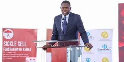 Health PS pushes for urgent sickle cell reforms as donor support declines