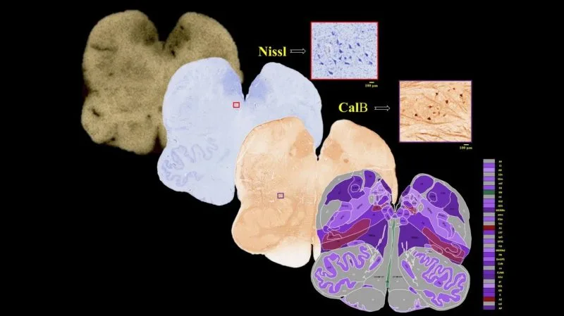 How Indian scientists are mapping the brain’s last frontier