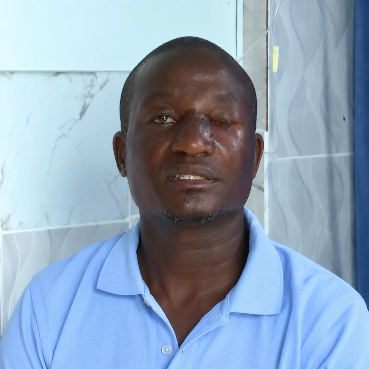 Mediamax Journalist Recounts Homa Bay Attack, Says He Was Injured and Robbed of Camera