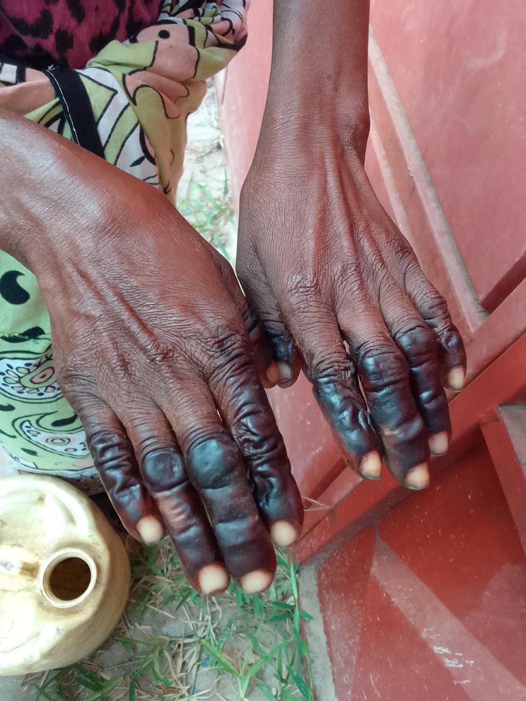 Kilifi cashew nut firm on the spot over workers neglect