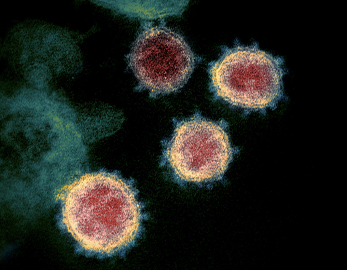 Scientist group: Evidence shows coronavirus evolved in nature