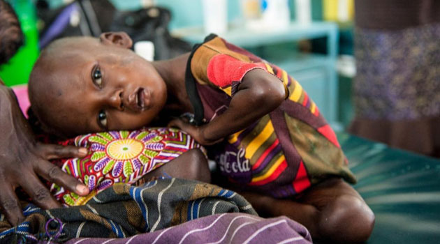 Children in drought-hit areas face greater risk of malnutrition: report