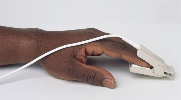 60 hospitals selected for test runs on pneumonia detection devices