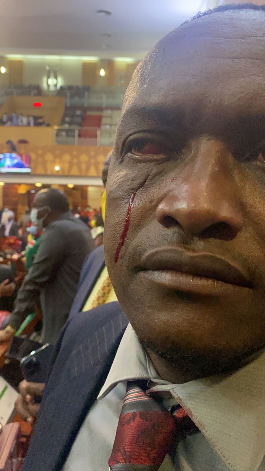 MP seriously injured during National Assembly chaos pitting Tanga Tanga and Kieleweke