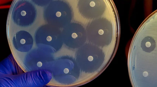 Antibacterial resistance overtakes HIV, Malaria to become leading cause of deaths