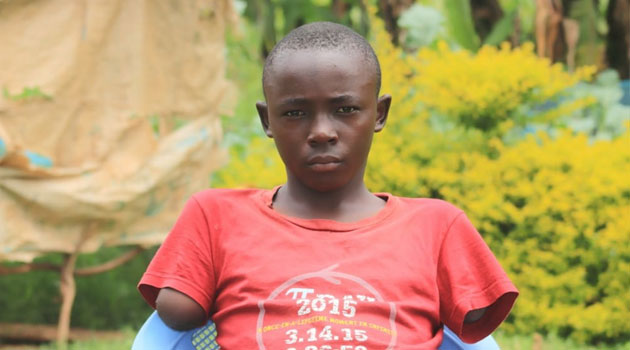 Family appeals for financial aid to buy prosthetic hands for 10-year-old boy
