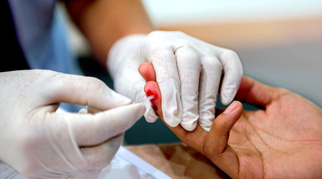 Men lagging behind on HIV tests: study reveals 8pc gap
