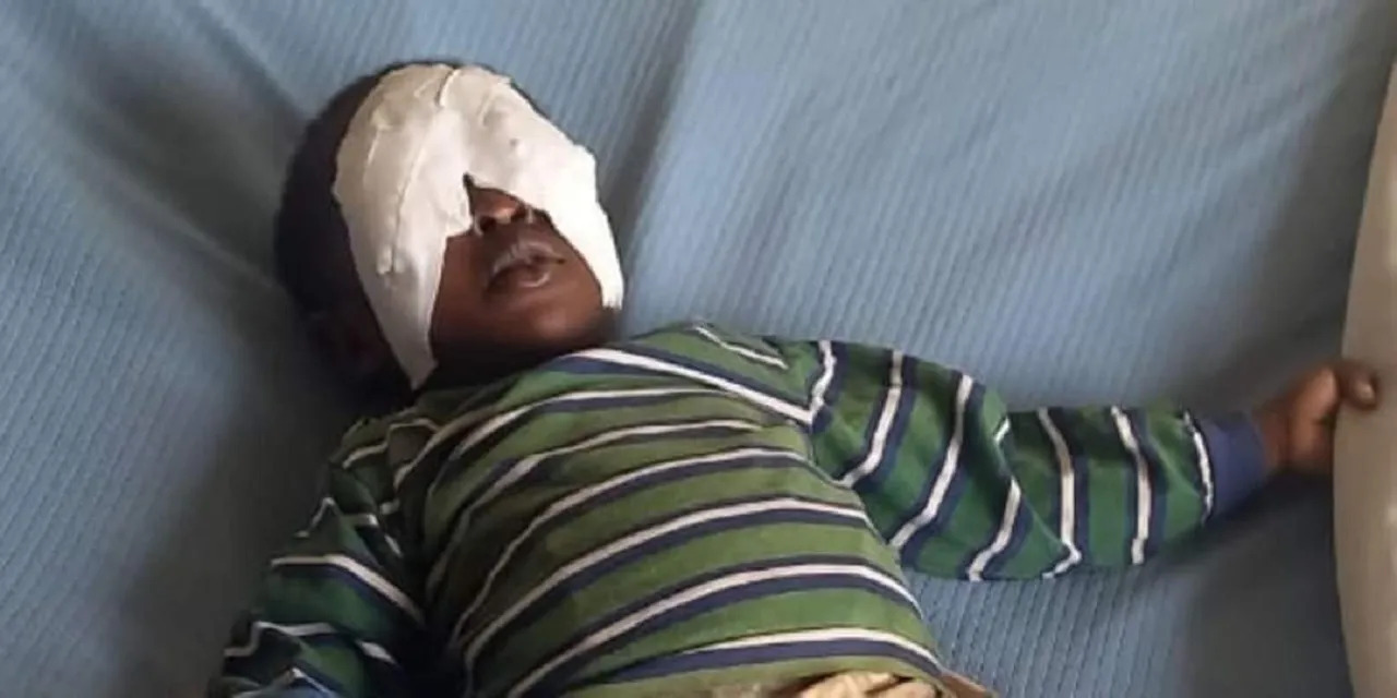 Baby Sagini says his ‘grandmother’ gouged out his eyes