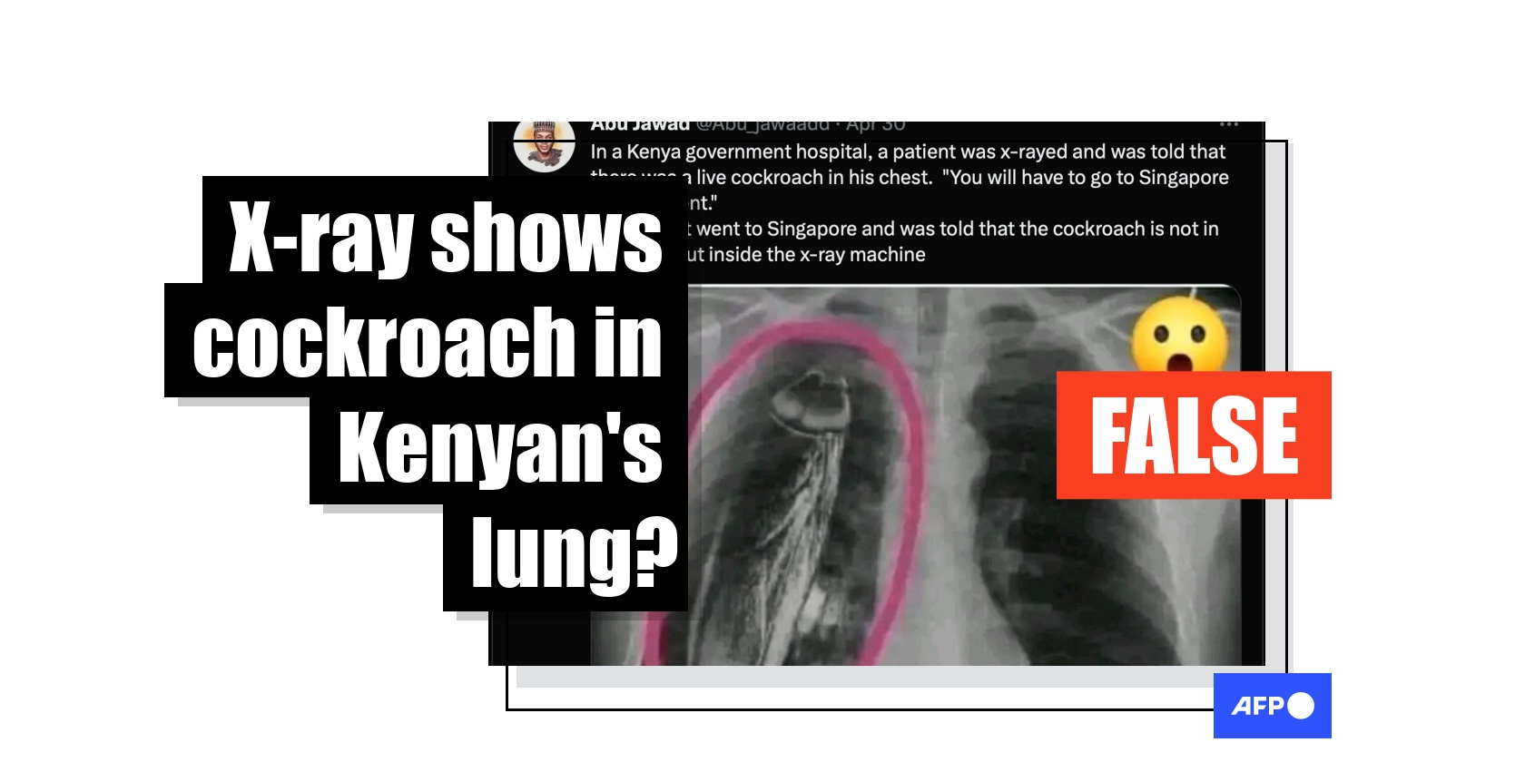 FACT CHECK: Cockroach X-ray hoax circulates in Nigeria and Kenya