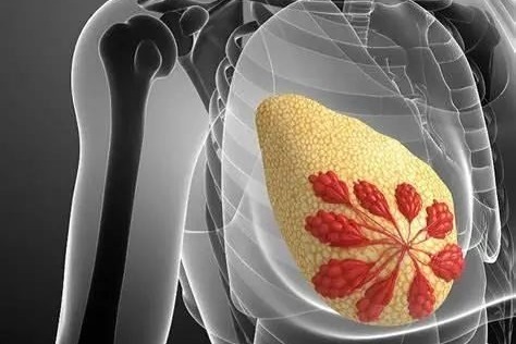Cost, stigma, and fear: Obstacles fueling late detection of breast cancer