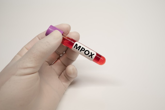 WHO approves 1st mpox vaccine for global use