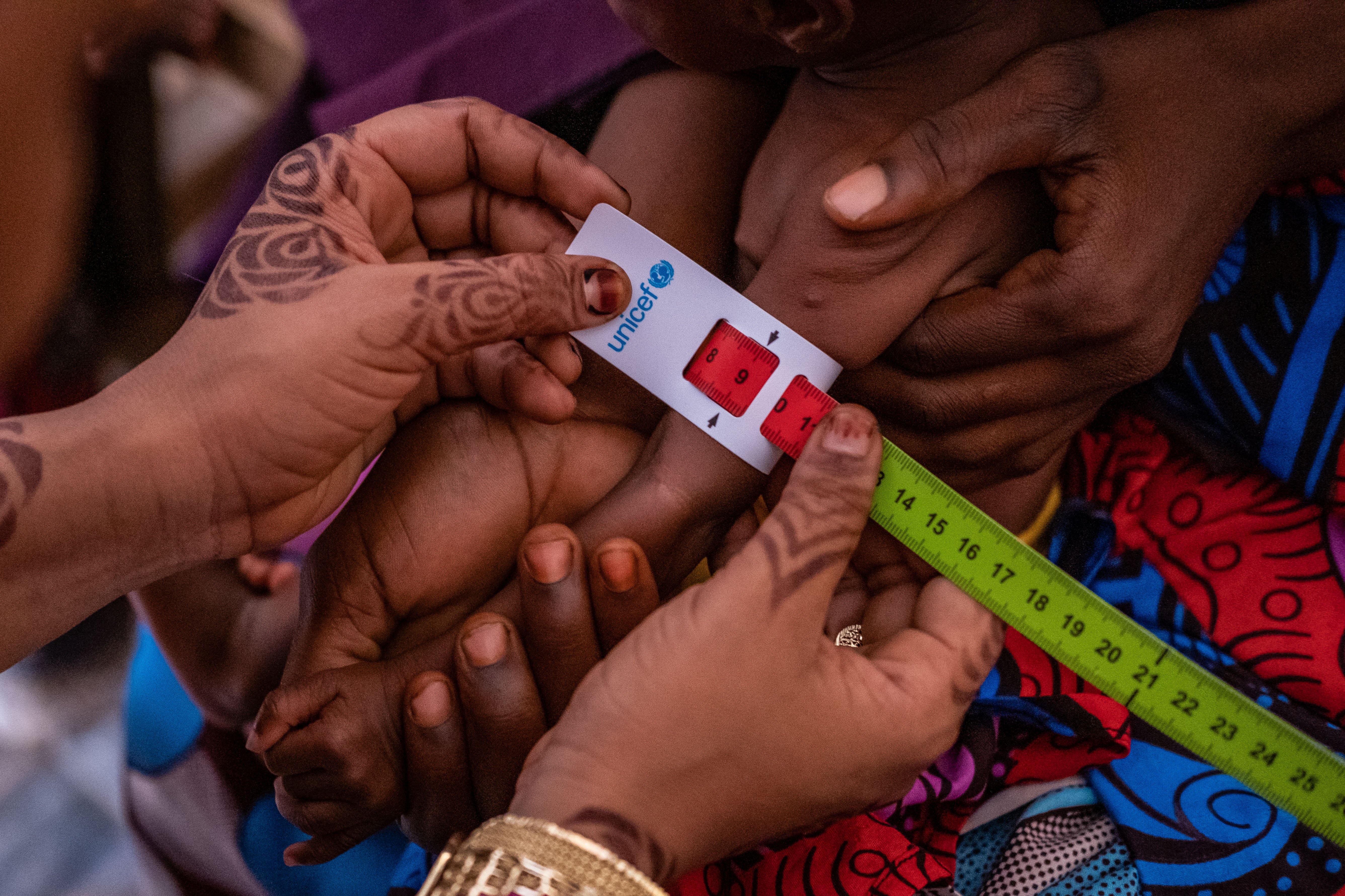 Kenya grapples with triple burden of child malnutrition