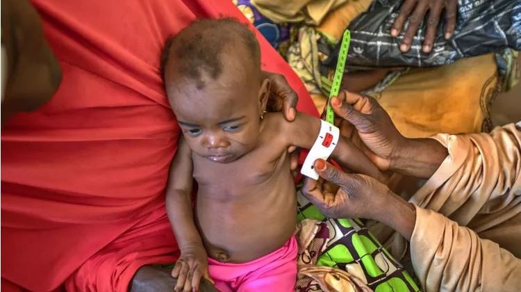 Medieval skeletons reveal the lasting damage of childhood malnutrition – new study