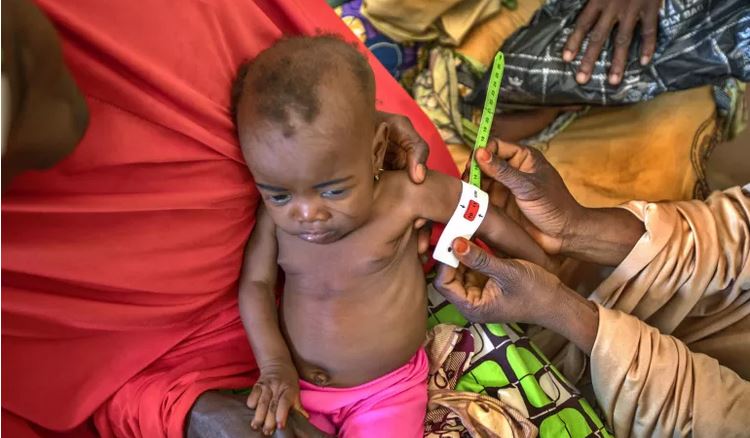 Medieval skeletons reveal the lasting damage of childhood malnutrition – new study