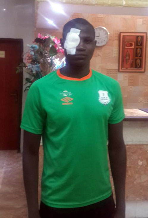 Harambee Stars midfielder Anthony Akumu was pelted by a stone from the fans in their 2-0 CAF Champions League return-leg clash away to Guinean outfit Horoya.PHOTO/Zesco Facebook